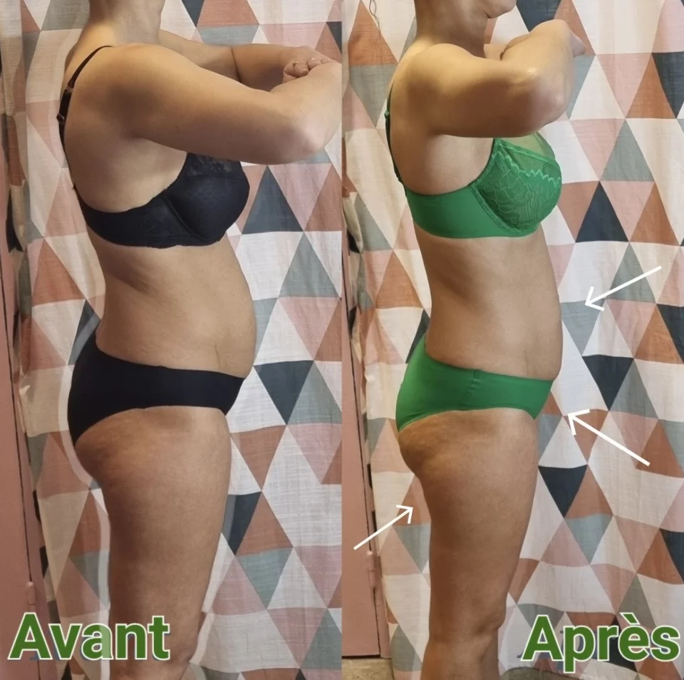 Avant et après — Ventre et taille
