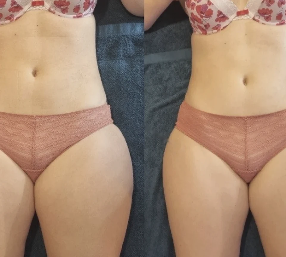 Avant et après — Taille et jambes
